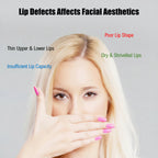 Portable Wireless Lip Enhancement Tool For Fuller Defined Lips